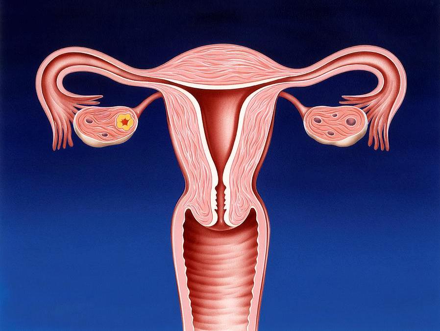 Биофизический профиль матки - ультразвуковая оценка.