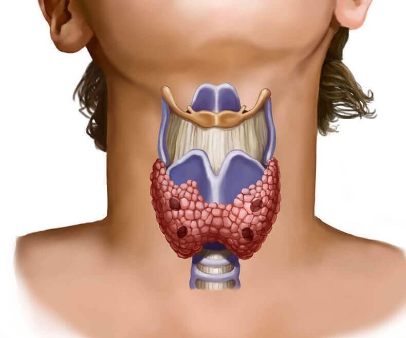 Ультразвуковое исследование щитовидной железы