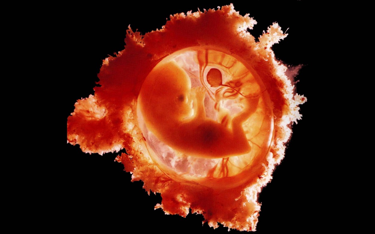 Эмбриогенез мочеполовой системы человека